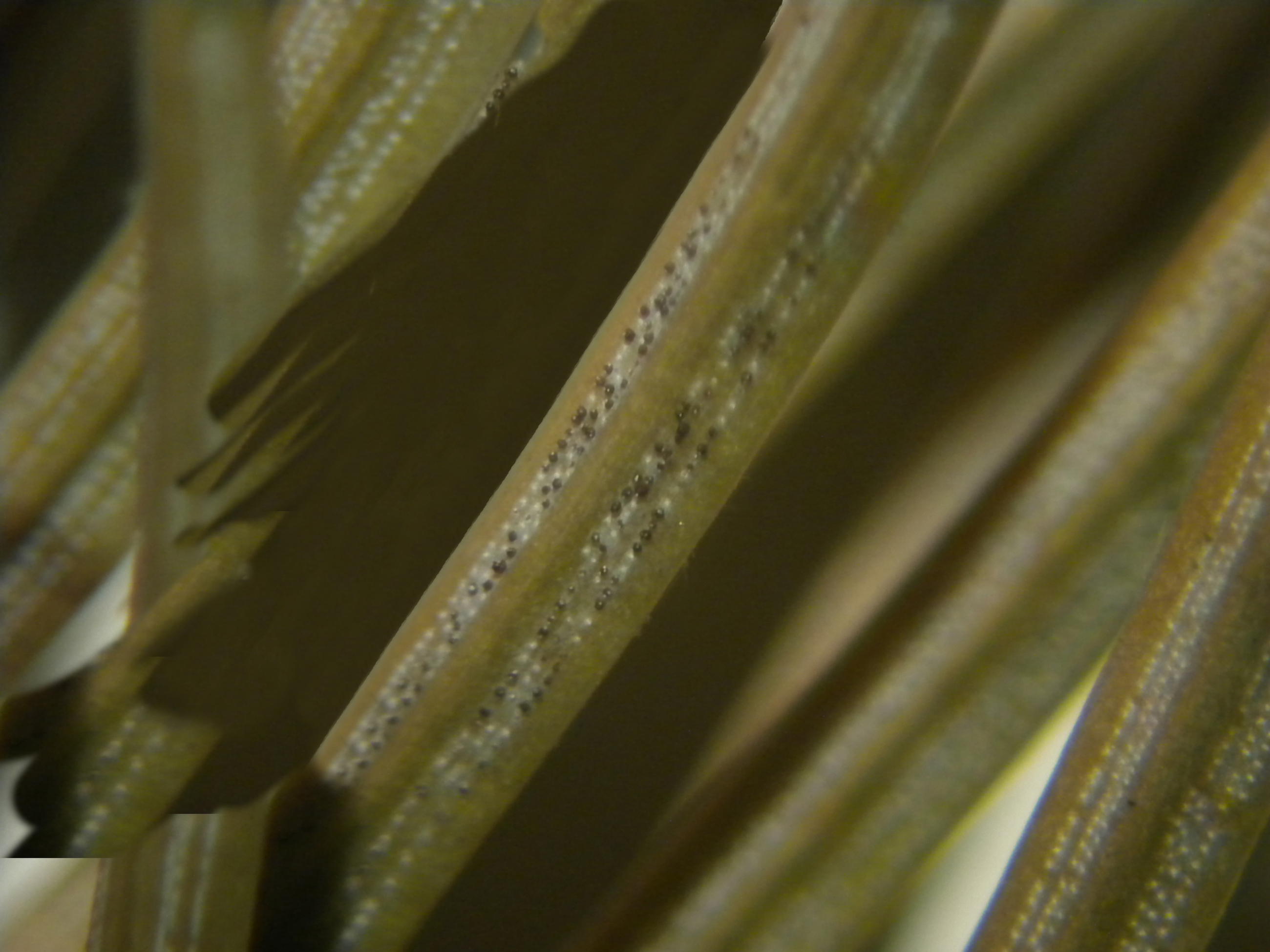 Rhizosphaera Needlecast Fruiting Structures 2 Spec